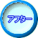 アフター
